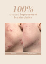 Rescue Serum - Image 4